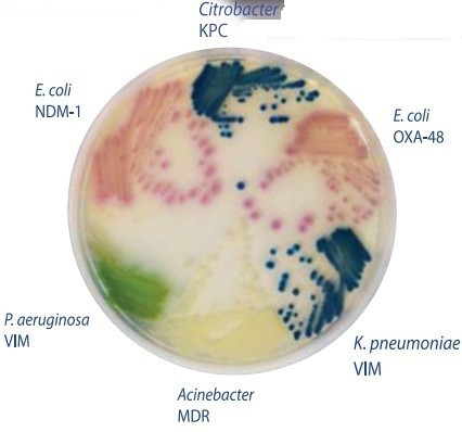 Hylabs̼ùϩˎcUCREzy(c)֬B(yng)